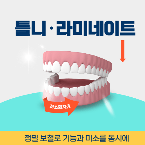 나주치과 나주시 치과 틀니 라미네이트