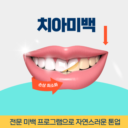 나주치과 나주시 치과 치아미백