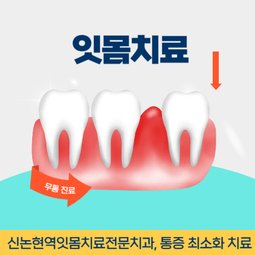나주치과 나주시 치과 잇몸치료